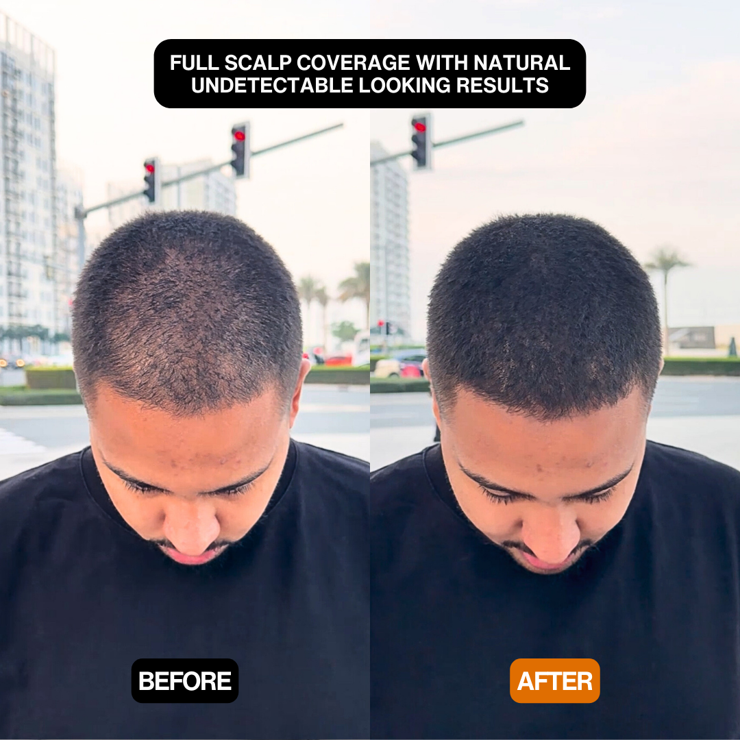 Hair Density Filler