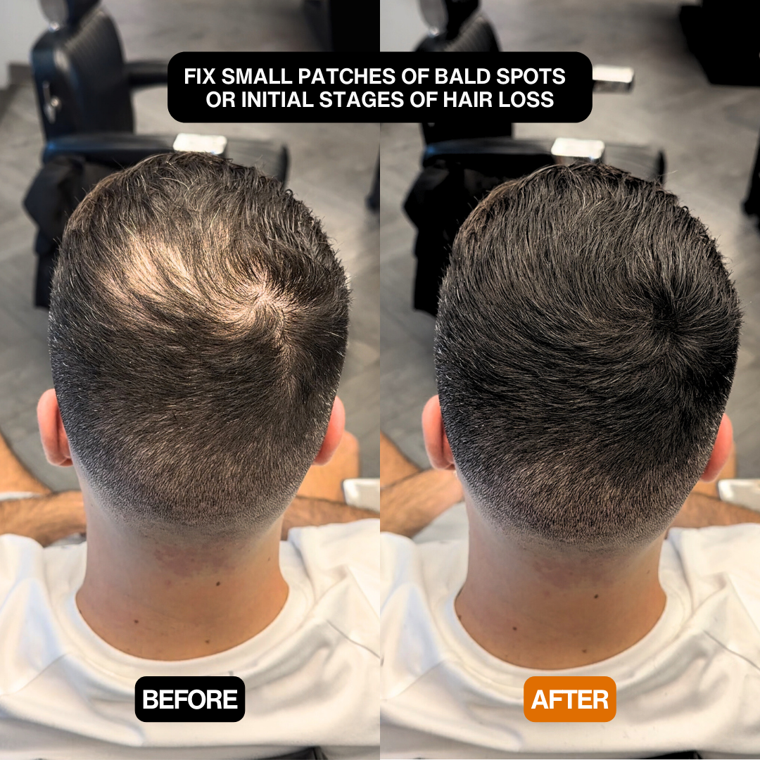 Hair Density Filler