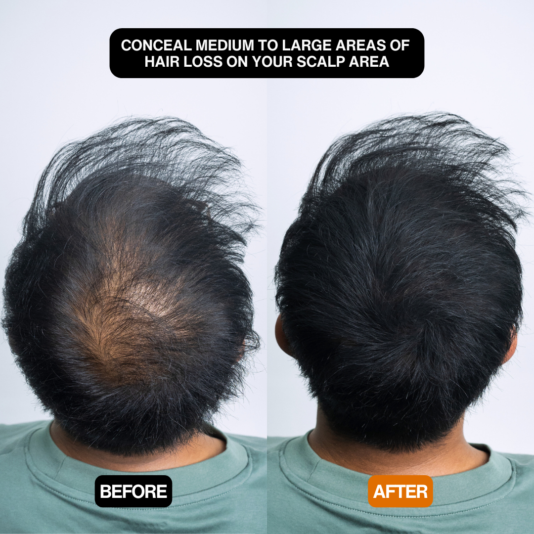 Hair Density Filler