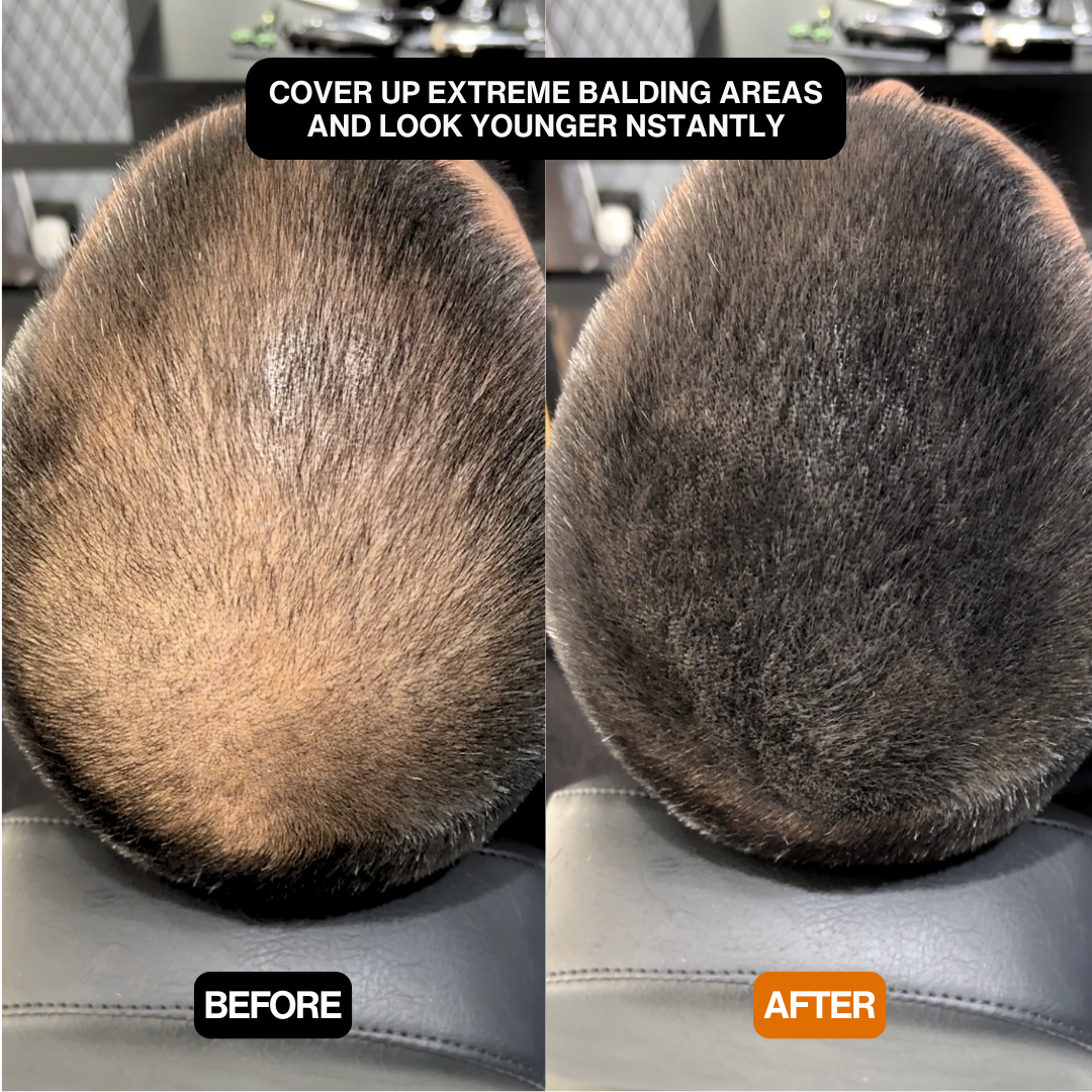 Hair Density Filler